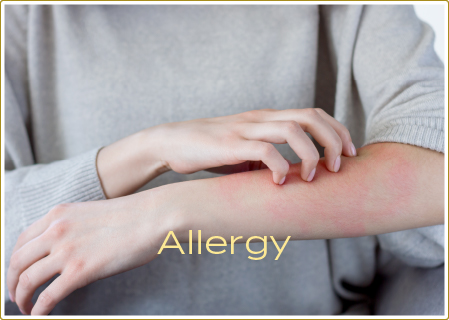 アレルギー科のイメージ写真